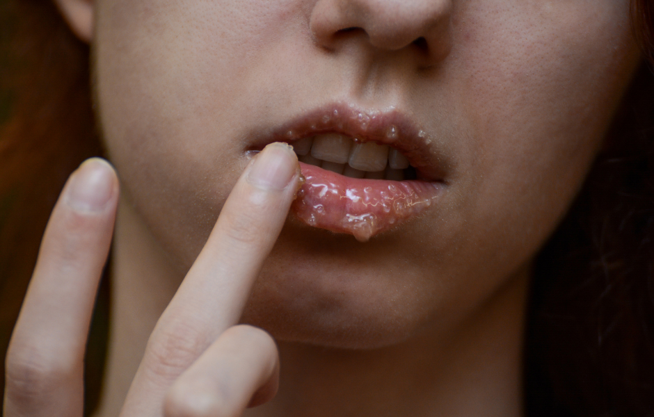 A close-up image shows a person's finger touching their lips, which are covered in a thick, messy, granular lip scrub, with some product visibly dripping.